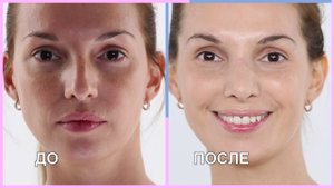 Перезагрузка: Как убрать пигментацию на лице