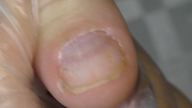 ЖЁЛТЫЕ НОГТИ Съел ГРИБОК ??! Маникюр для ИНОСТРАНКИ.Что с ногтями? ИСПОРТИЛИ Ногти. НАРАЩИВАНИЕ ВРЕ смотреть онлайн