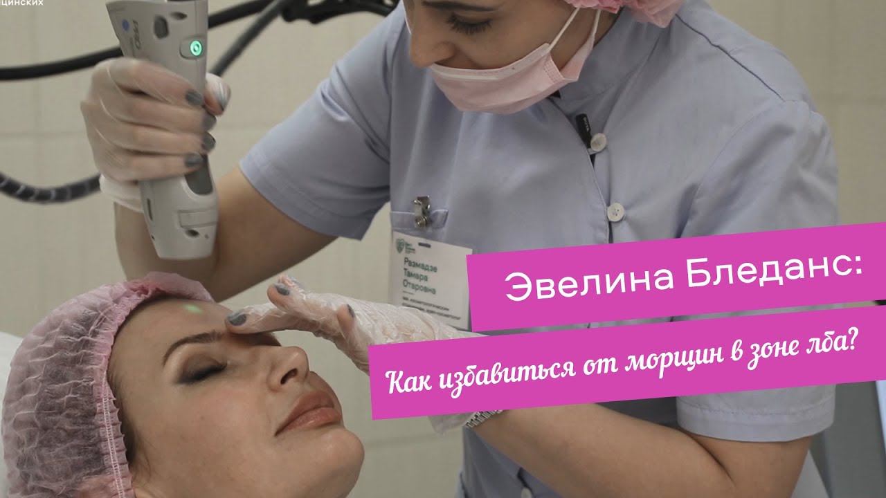 Эвелина Бледанс: "Как избавиться от морщин в зоне лба?" смотреть онлайн