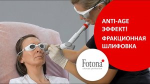 Фракционная шлифовка улучшает текстуру и тон кожи