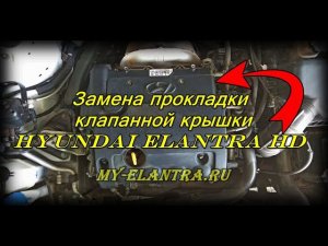 Замена прокладки клапанной крышки Hyundai Elantra HD!