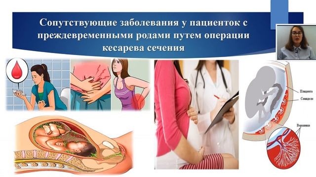 ИТОГИ ОПЕРАТИВНОГО РОДОРАЗРЕШЕНИЯ ПРИ ПРЕЖДЕВРЕМЕННЫХ РОДАХ