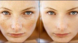 ИДЕАЛЬНАЯ КОЖА от пигментных пятен (уход за кожей) Медитация