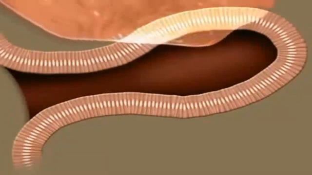 Желудочно кишечный тракт Как работает наш желудочно кишечный тракт смотреть онлайн