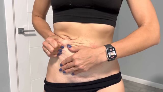 Как убрать складку на животе. Как убрать складку на животе после кесарева.Как убрать живот. смотреть онлайн