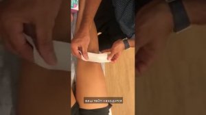 Тейпирование колена по МакКонелли