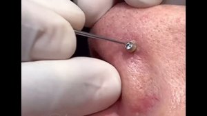 Чистка пирсинга / пирсинг / piercing Infection / piercing cleaning / piercing