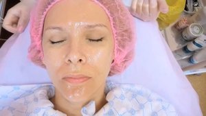 Химический миндальный пилинг лица