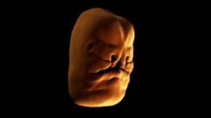 Процесс формирования у эмбриона человека лица. ast752.ru