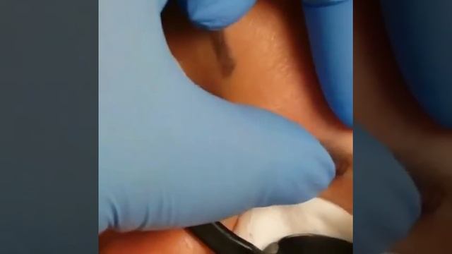 Lion tattoo studio лазерное удаление некачественного татуажа смотреть онлайн