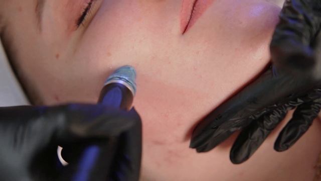 Вакуумная чистка HYDRAFACIAL