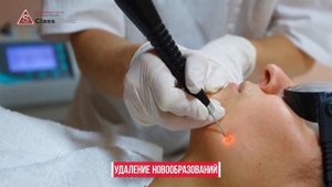 Удаление родинок Эс Класс Клиник
