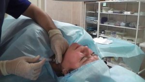 Боль в шее лечение селективная корешковая блокада