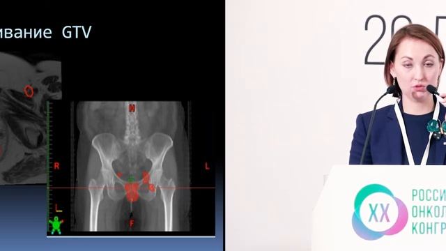 Разбор 2 клинического случая – пример роли хирурга смотреть онлайн