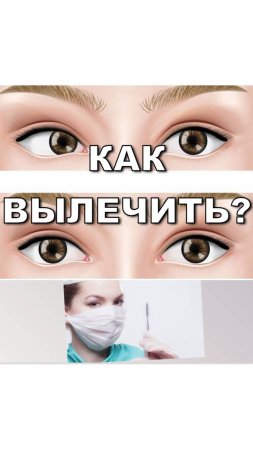 Косоглазие у взрослых, как это вылечить?