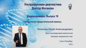 УЗИ. Доктор Иогансен. Видеопримеры. Выпуск 19. Гиперплазия предстательной железы.