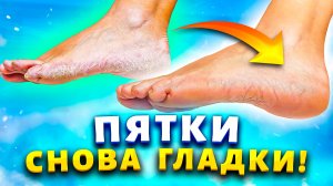 Нежные пяточки цвета "поросят". Смешала 2 ингредиента и убрала натоптыши, сухие мозоли, трещины