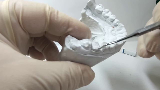 Штампованная коронка смотреть онлайн