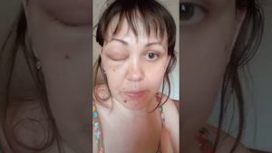 Что делать если укусила пчела!? Первая помощь при укусе пчелы. #укуспчелы #укусилапчела#перваяпомощ