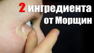 Как убрать морщины Вокруг глаз - Два ингредиента от морщин вокруг глаз, делюсь рецептом