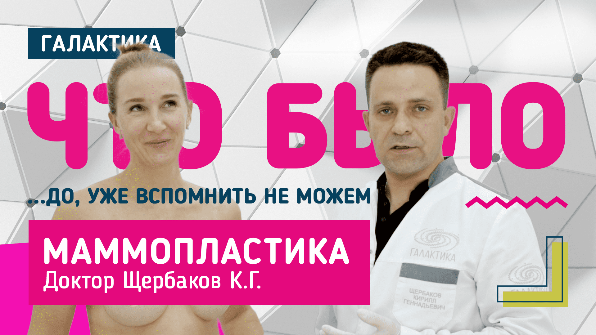 Увеличивающая маммопластика: результат | Щербаков Кирилл Геннадьевич