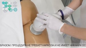 БЕЗОПЕРАЦИОННАЯ ЛИПОСАКЦИЯ BODY UP на аппарате ACCENT Сеть клиник косметологии GEN87