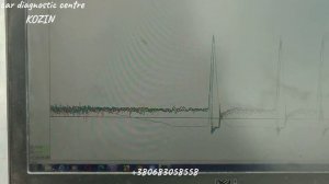 Фольксваген Джетта ошибка по рассинхронизации