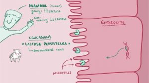 Lactose intolerance - causes, symptoms, diagnosis, treatment & pathology