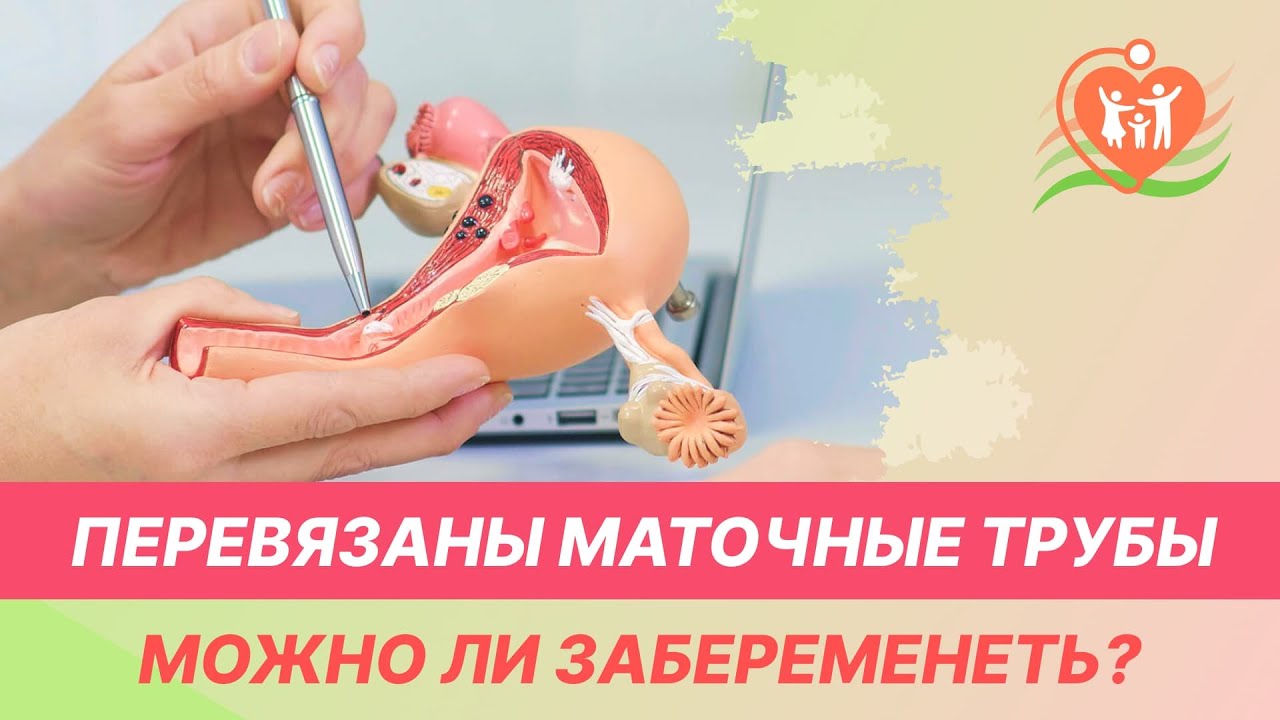 Перевязать трубы у женщины последствия на организм. Как забеременеть если перевязаны трубы. Когда трубы перевязаны можно забеременеть. Можно ли забеременеть если перевязаны трубы. Можно ли сделать эко с перевязанными трубами.