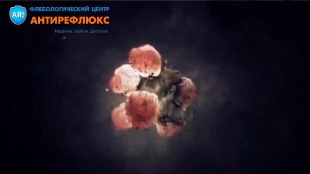 склеротерапия это