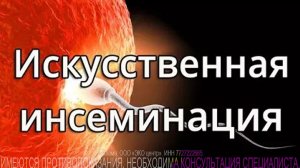 Внутриматочная инсеминация