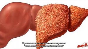 Лечение жирового гепатоза печени