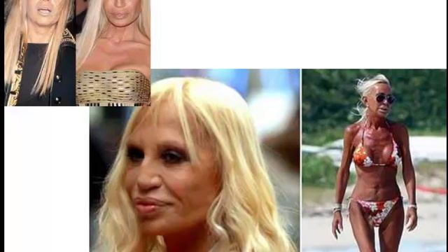 Как избавиться от морщин? Эффективно! смотреть онлайн