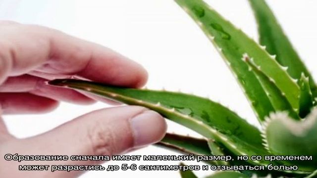 Шарик или шишка в мочке уха смотреть онлайн