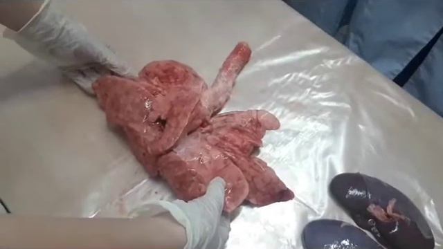 Мастер-класс по основам препарирования внутренних органов. смотреть онлайн