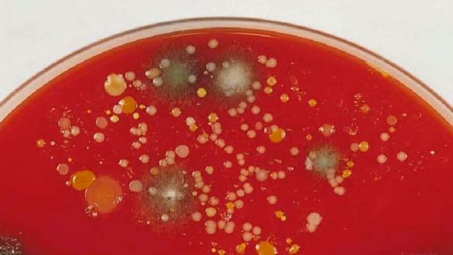 Lab 06 Bacteria in the Environment смотреть онлайн