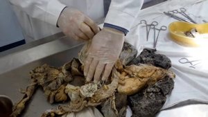 Ривизия органа брюшной полости