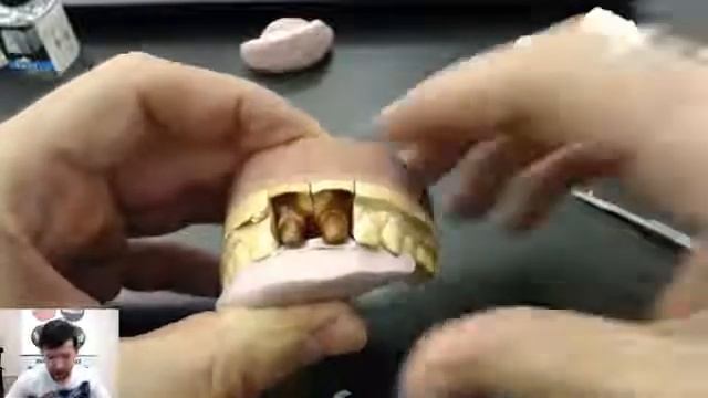 Моделирование 2 каркасов #11-21 из воска под прессовку из #emax смотреть онлайн