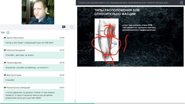 вебинар Схема ультразвукового исследования вен