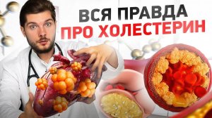 Как снизить холестерин? / Простые способы снижения холестерина