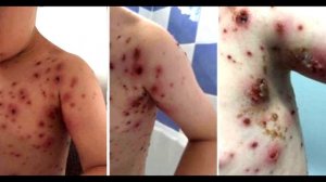 После приема таблетки малыш кричал на весь дом от боли. Тогда мама поняла, что сделал врач…