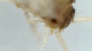 Чешуйница под микроскопом