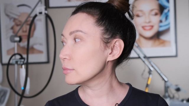 Отзыв о центре здоровья и красоты "Романов", после процедуры Ультраформер СМАС-лифтинг смотреть онлайн