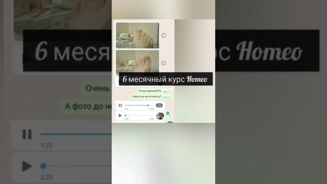 Лечение ногтей дома. Доставка по всему миру!Переходи в инстаграм или пиши на Вайбер или Ватсапп смотреть онлайн