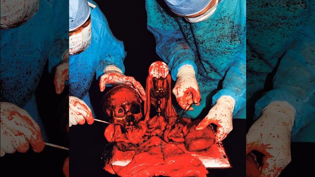 Degloved смотреть онлайн