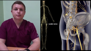 Блокада седалищного нерва Как делается Sciatic Nerve Block