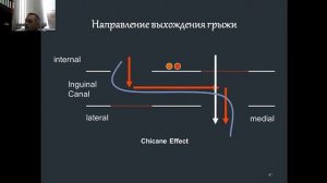 Факультетская хирургия №11 "Грыжи передней брюшной стенки и их осложнения. "