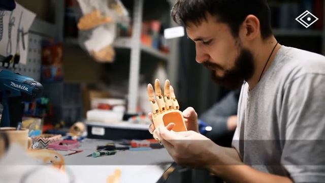 Уникальные детские протезы от компании Моторика смотреть онлайн