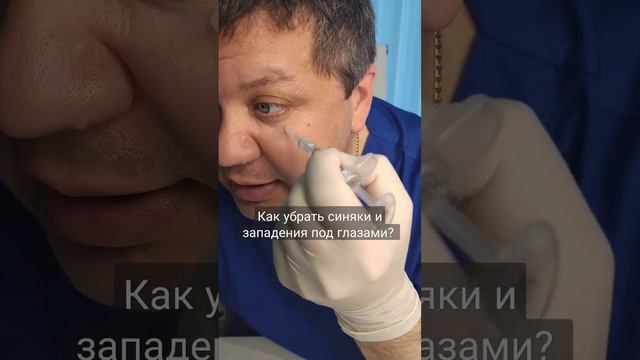 Как убрать синяки и западения под глазами?