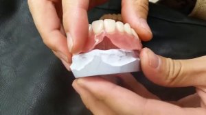 Съёмные протезы из акри-фри